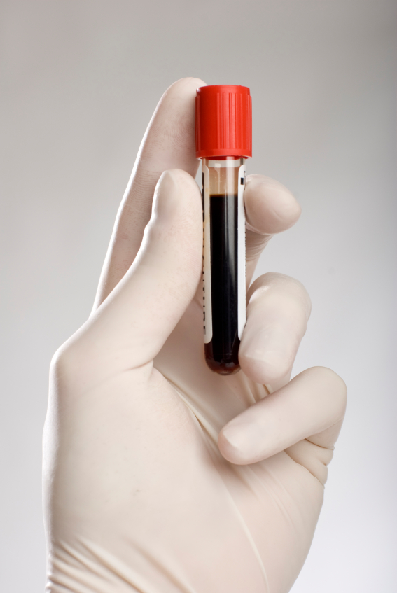 hand holding blood in test tube close up
